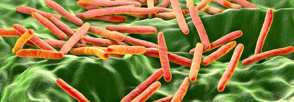  Mycobacterium bovis